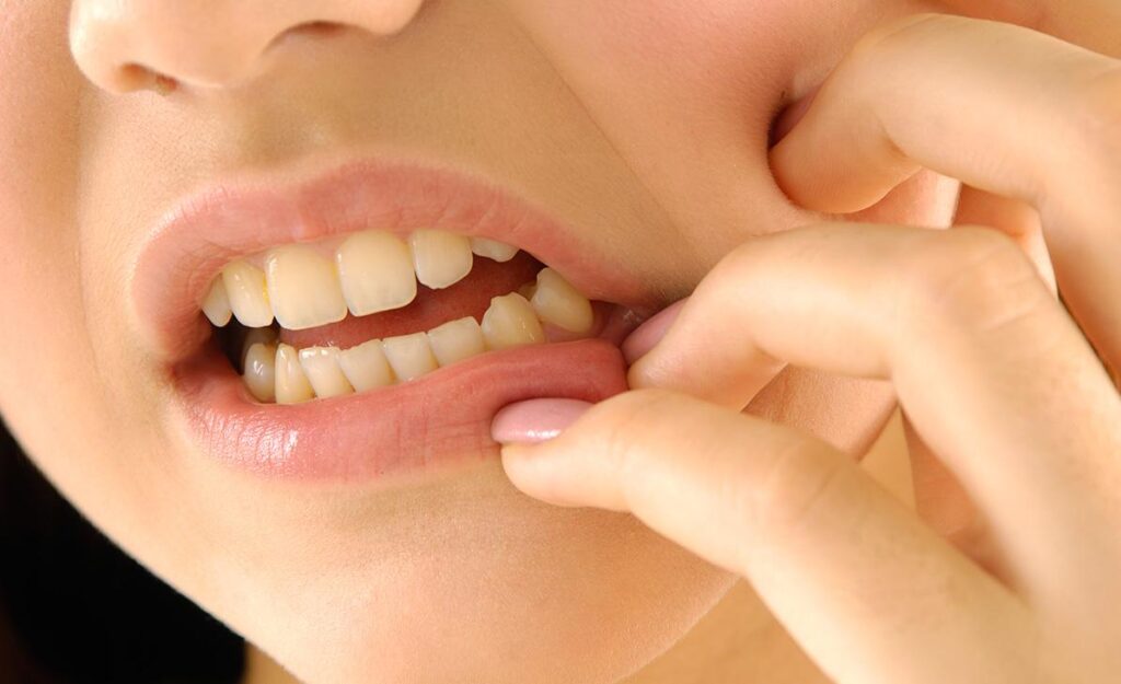 ¿ENCÍAS INFLAMADAS? Odontologists