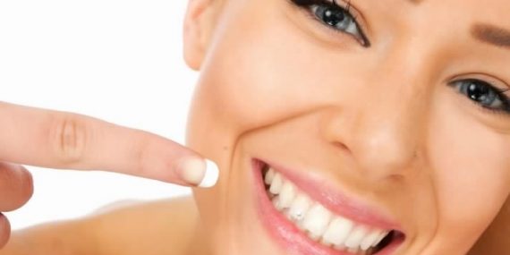 blanqueamiento dental
